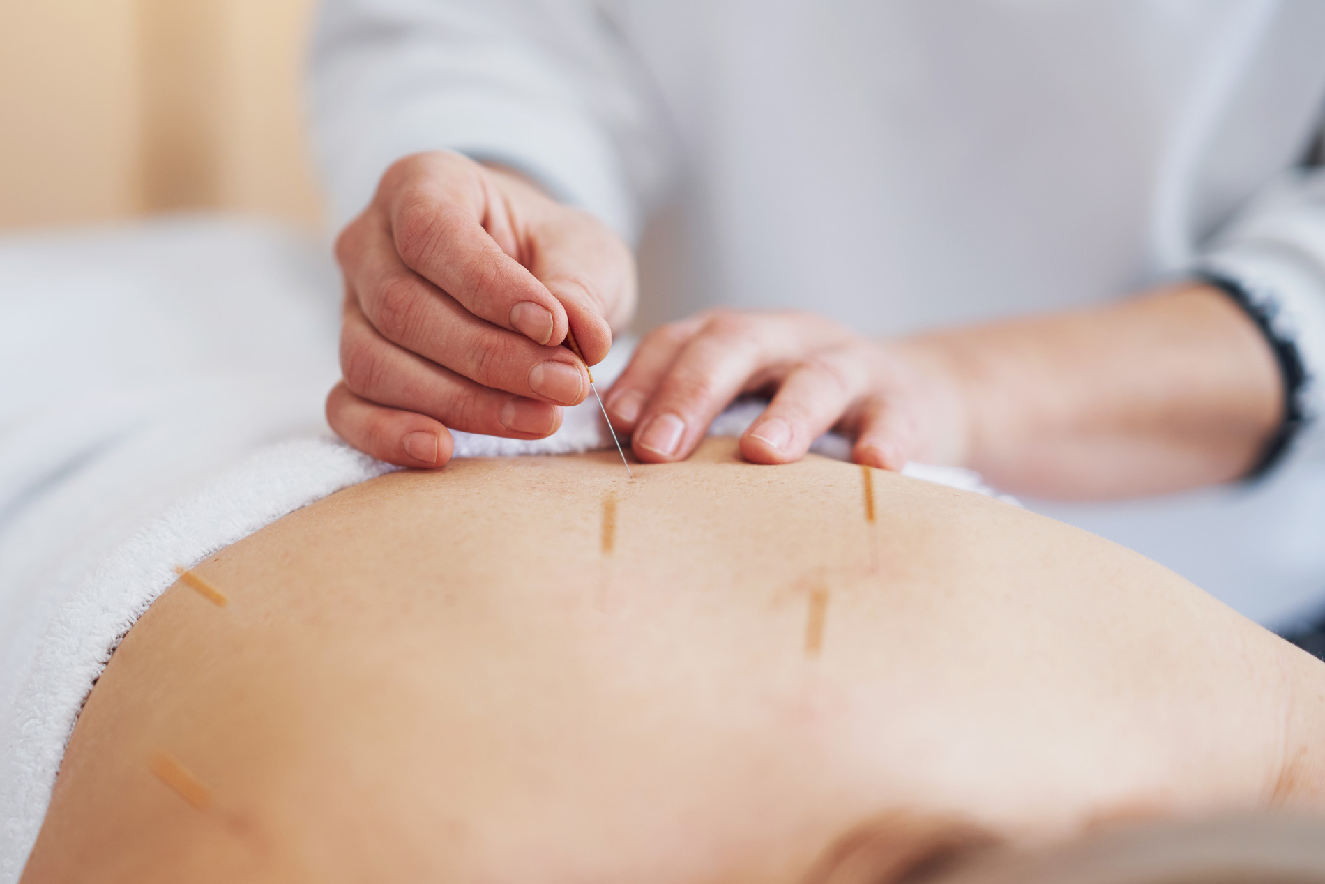 Clinique-école d'acupuncture